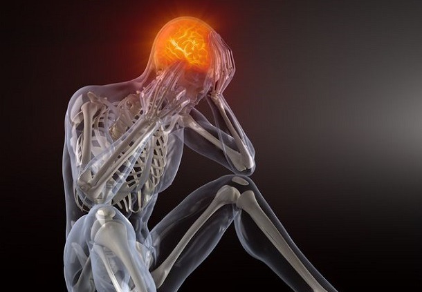 Wie die Vitalstoffe Vitamin D, Vitamin B und Q10 bei Migräne helfen 1 starke Migräne und Kopfschmerzen