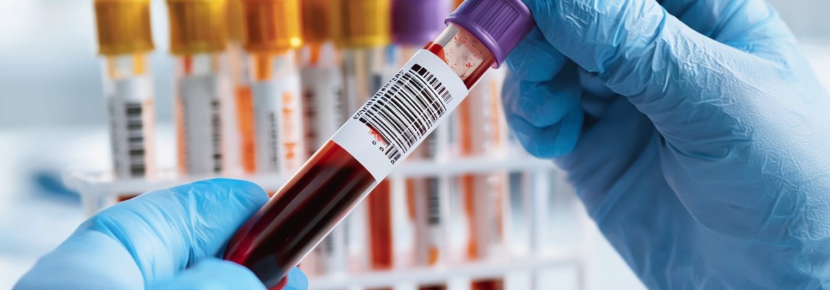 KI Blutabnahme Ampulle