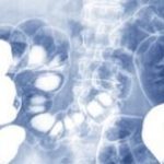 bauchraum fotolia 213024627 Tonpor Kasa 1600px min 1024x520 1 300x152 1