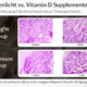 Sonnenlicht vs. Vitamin D: Einfluss auf die Knochen 2 Histologischer Vergleich: Sonnenlicht-Gruppe vs. Supplement-Gruppe mit Vorher-Nachher-Knochenstruktur (Tierexperiment)
